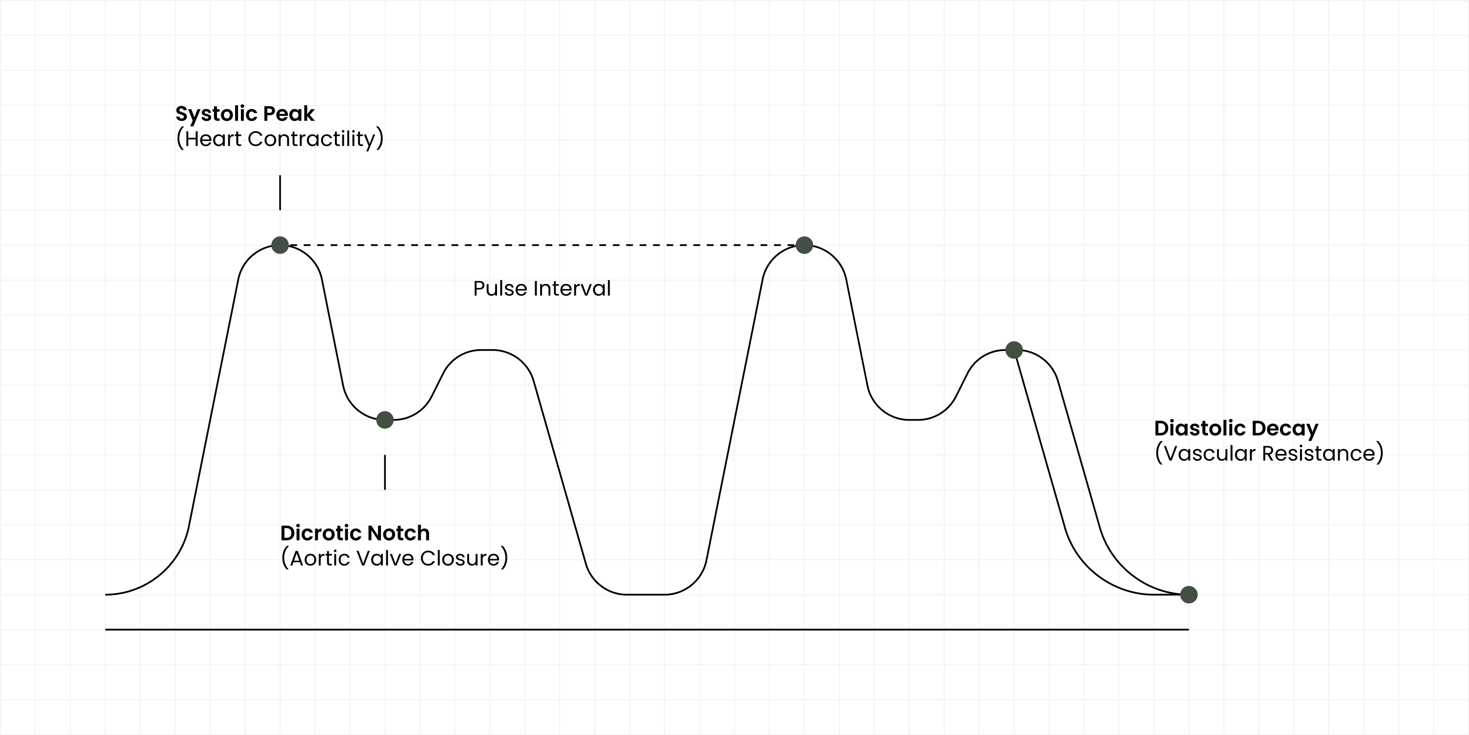 Pulse waveform diagram labeling systolic peak, pulse interval, dicrotic notch, and diastolic decay